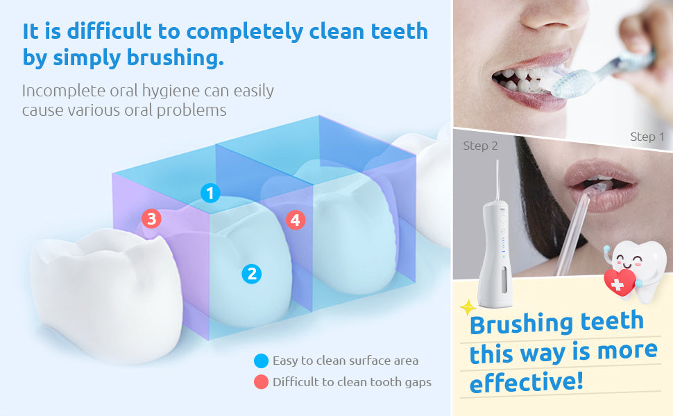 SYNHOPE water flosser demonstrates superior cleaning compared to brushing alone. Highlights hard-to-reach areas that regular brushing misses, promoting better gum health.